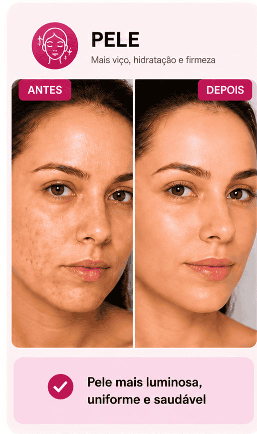 Antes e depois — pele